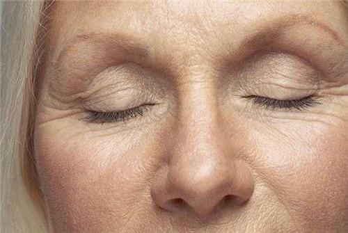 脸上的皱纹怎么去掉最好方法,脸上的皱纹怎么去除最简单的方法