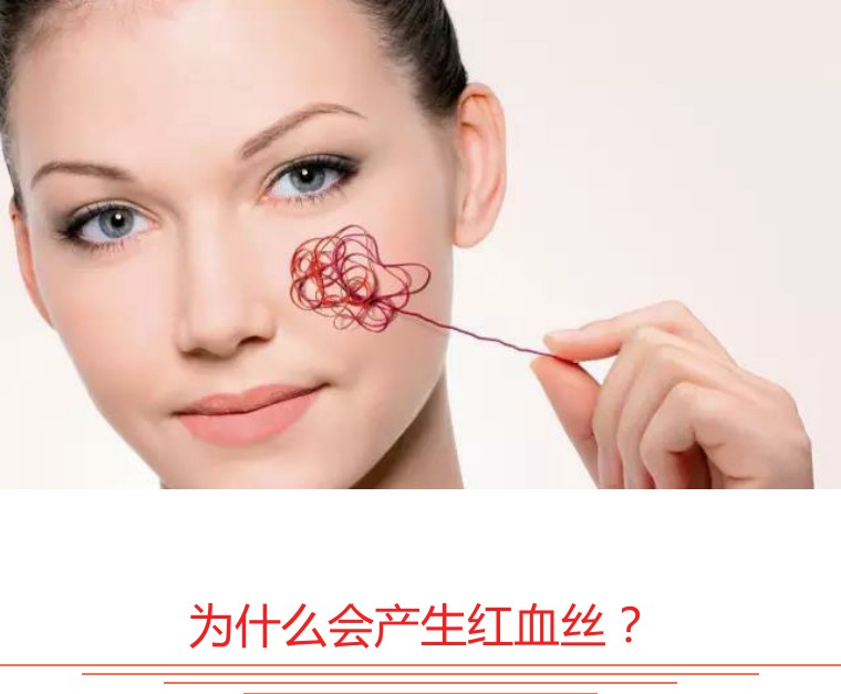 大腿上有血丝怎么祛除,血丝色斑