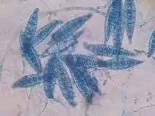 梅雨季猫癣症状,天气连续潮湿猫癣高发期