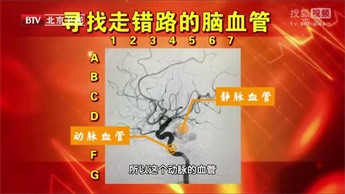 记忆大师提高记忆力的课程,国际记忆大师记忆力训练的方法