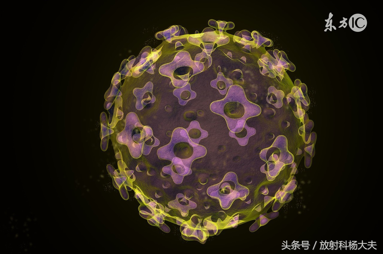mr能查出宫颈癌早期吗,宫颈癌怎么从mr报告上看早晚期