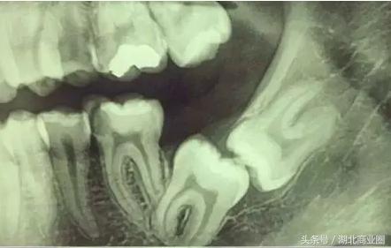 探店：在奢侈级口腔医院里做一把“上帝”