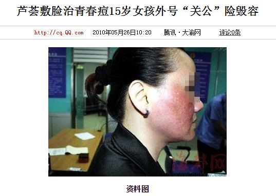 家里种植的芦荟真的可以祛疤吗,家里种的芦荟可以消炎吗