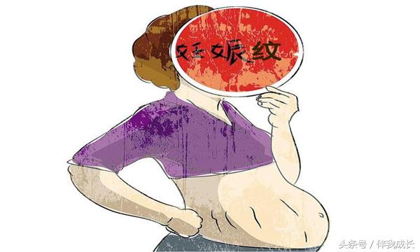 一分钟带您搞懂妊娠纹