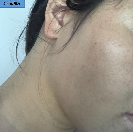 面霜会影响皮肤呼吸吗,呼吸面霜价格多少