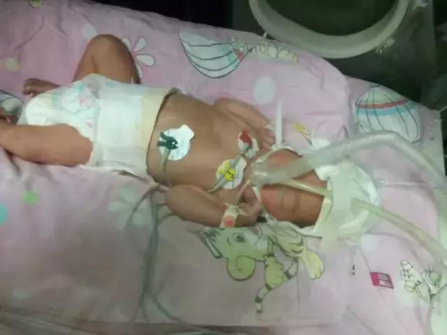 老公在外面签字保我，我在里面签字保孩子：31孕周早产儿妈妈凶险性前置胎盘并大出血，休克2次，子宫摘除