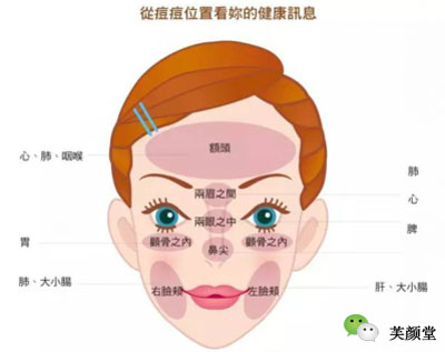 长痘位置决定了清痘方式,恐怕你还不知道吧!
