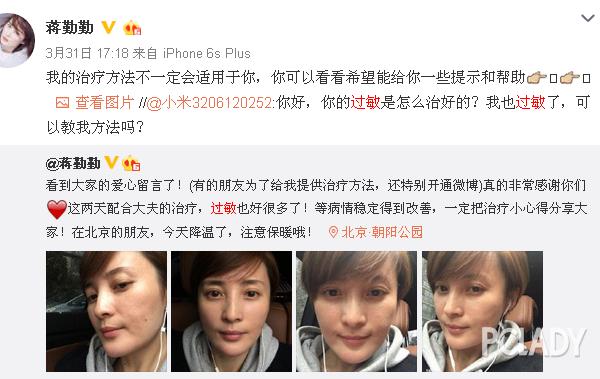 紫外线过敏舒淇,舒淇敏感肌怎么自救