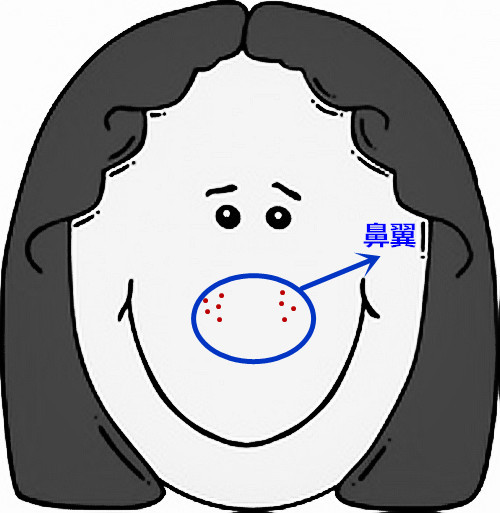 脸部痘痘看身体状况,超全面面部痘痘分析图文