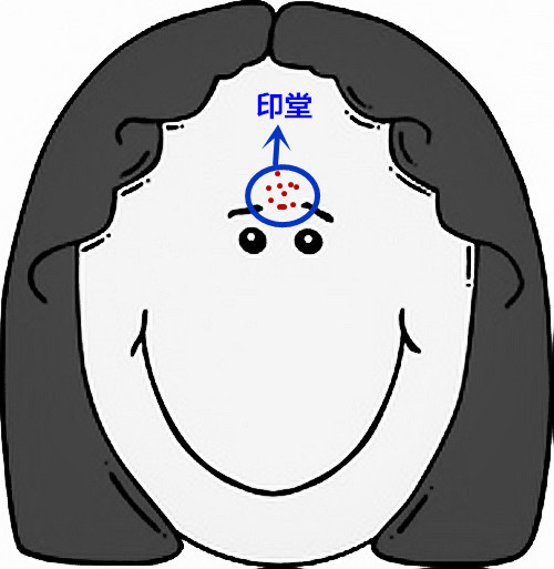 脸部痘痘看身体状况,超全面面部痘痘分析图文