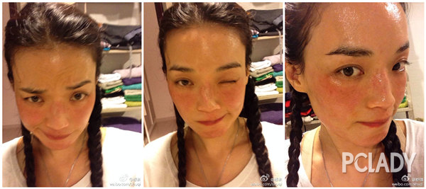 紫外线过敏舒淇,舒淇敏感肌怎么自救