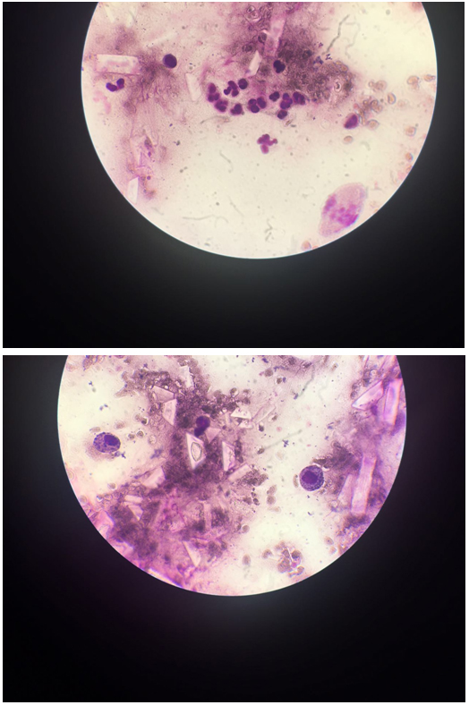 猫膀胱炎尿血但是精神正常,猫膀胱炎尿不出来怎么办