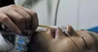 全麻术后口渴的解决方法,垂体瘤术后口渴是怎么回事