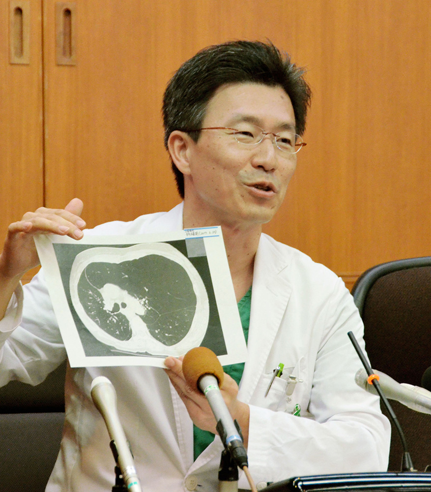 中国肺移植第一人创世界首例,世界第一双肺移植