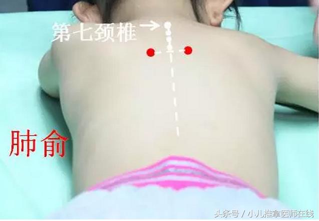 三伏贴都贴哪些穴位,三伏贴适合贴什么穴位呢