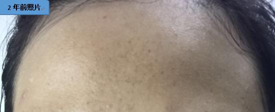 面霜会影响皮肤呼吸吗,呼吸面霜价格多少