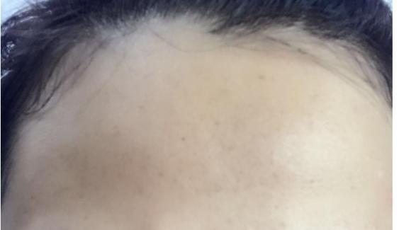 面霜会影响皮肤呼吸吗,呼吸面霜价格多少