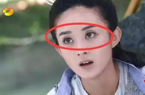 拿什么拯救术后三眼皮