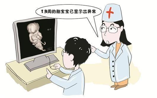 生个健康的宝宝需要孕前准备什么,孕前需要给宝宝准备啥