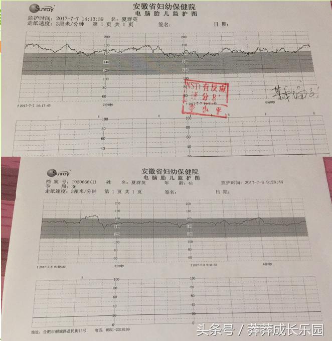 胎心监护基线偏高怎么办,胎心监护中基线偏高怎么办