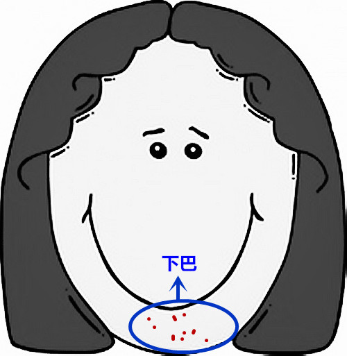 脸部痘痘看身体状况,超全面面部痘痘分析图文