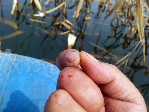 鱼钩刺肉如何处理,倒刺鱼钩钩进衣服怎么办