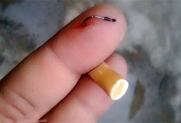 鱼钩刺肉如何处理,倒刺鱼钩钩进衣服怎么办