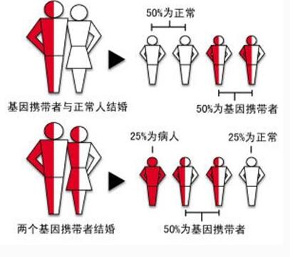 什么叫地中海贫血原因,地中海贫血为什么不是必检项