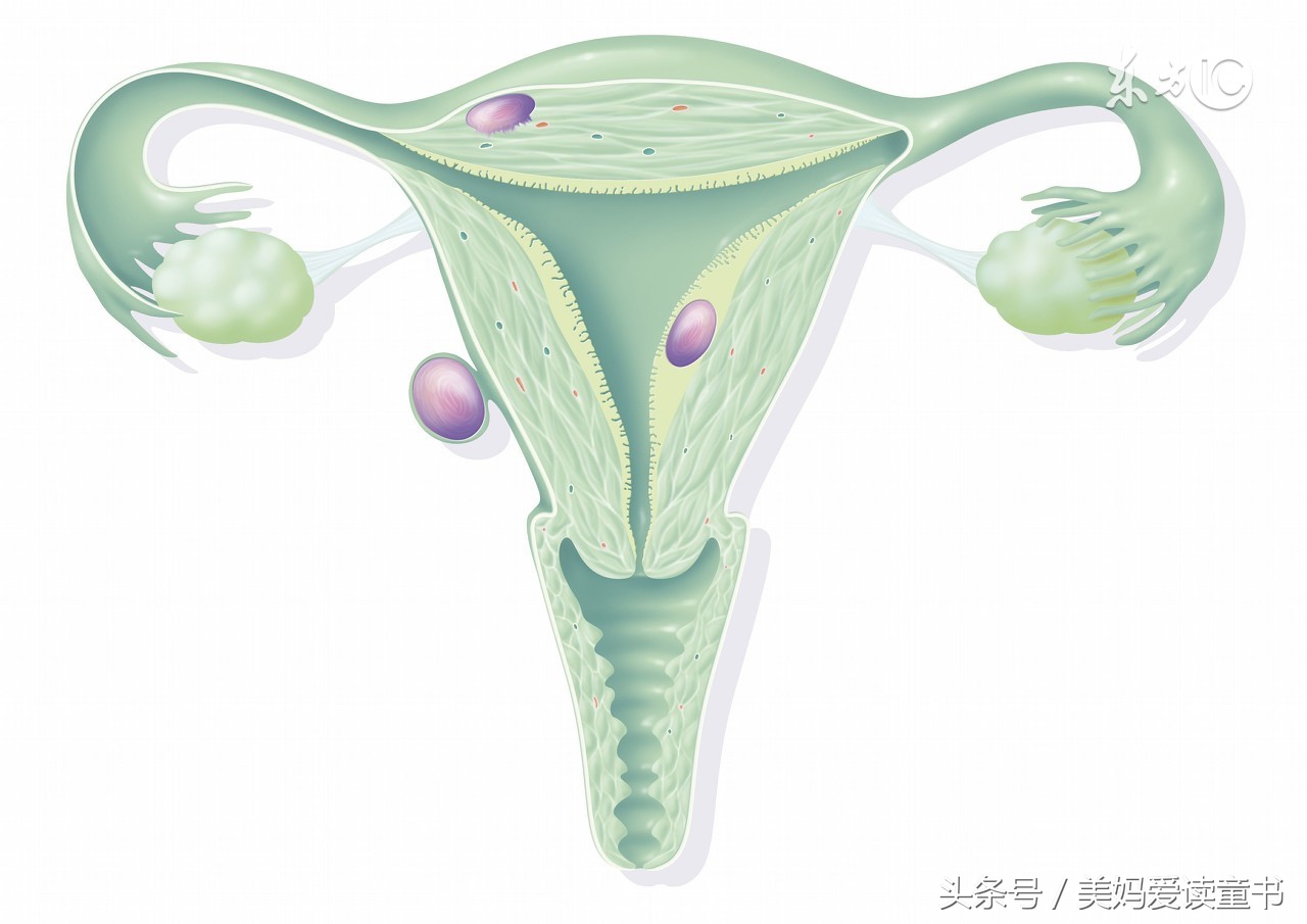 寰椾簡瀛愬鑲岀槫鍦ㄥ摢鍋氭墜鏈ソ,瀛愬鑲岀槫娌荤枟瀹d紶
