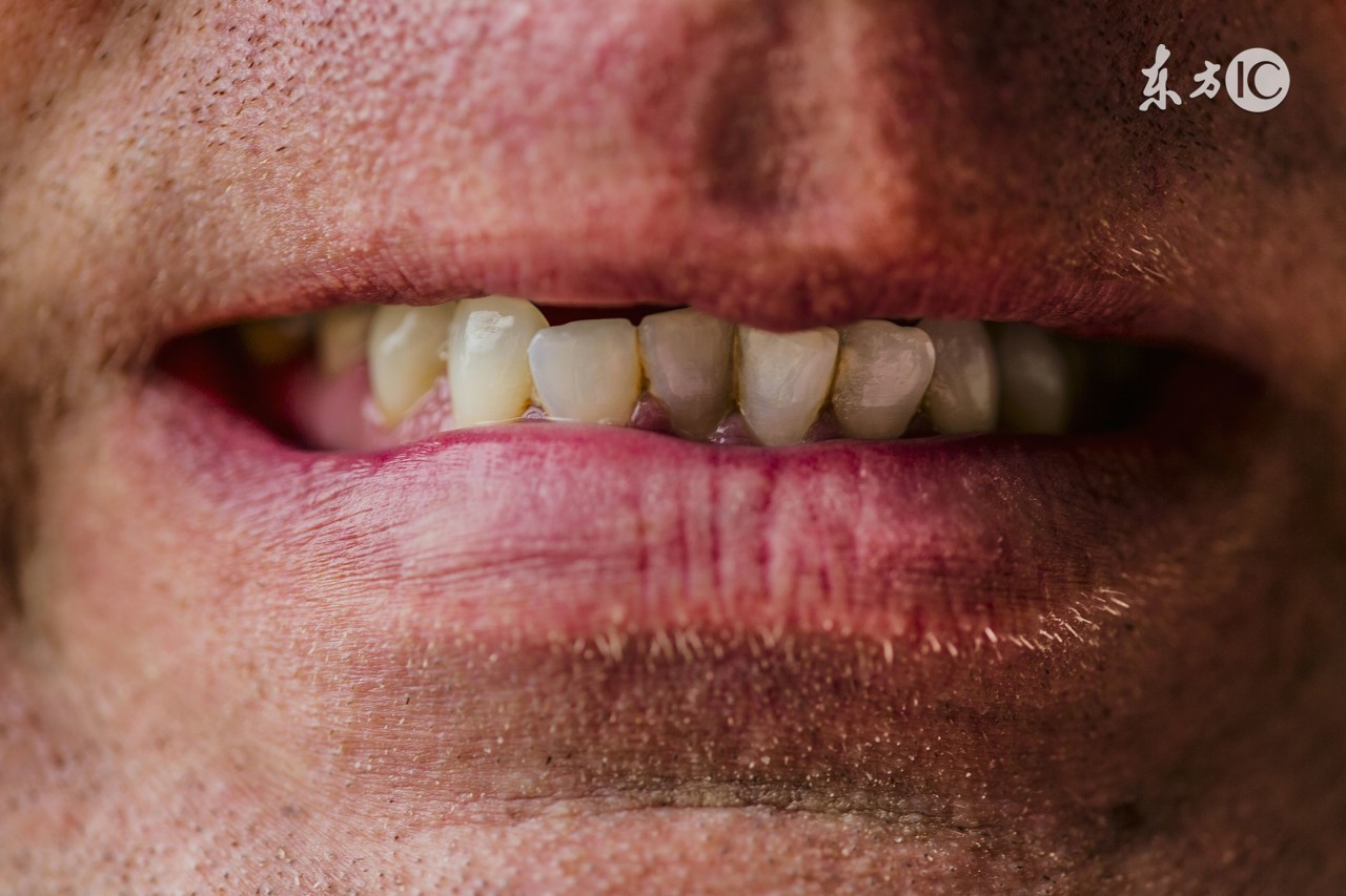 牙齿是长在牙龈上还是牙板上,牙齿是长在肉里还是骨头上