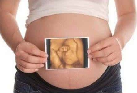 孕期做B超并不是你想象中的那么简单,这些事情你注意过吗?