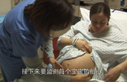 孕妇剖腹生下双胞胎惊呆医生,双胞胎出生过程实录