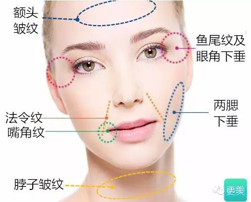 脸部缝美容线好还是普通线好,医院埋线和美容院埋线有什么差别