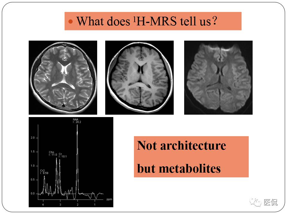 神经系统解剖ppt课件,神经内科课件ppt