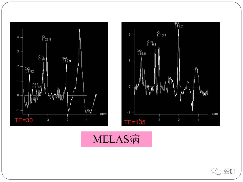 神经系统解剖ppt课件,神经内科课件ppt