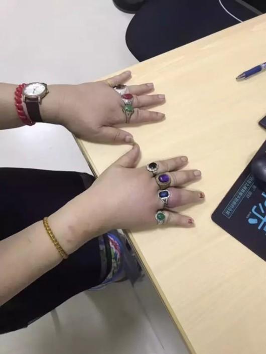 鎵嬫寚琚垝鎸囧崱浣忎簡鍘绘秷闃查槦,7鏍规墜鎸囪鎴掓寚鍗′綇