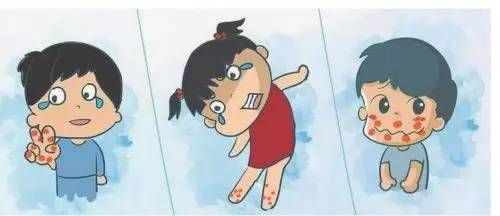 骞煎効鎵嬭冻鍙ｇ梾棰勯槻鐭ヨ瘑,棰勯槻鎵嬭冻鍙ｇ梾娓╅Θ鎻愮ず