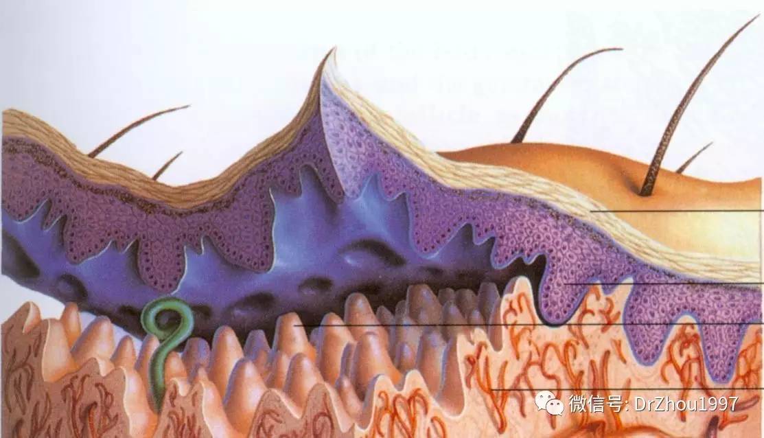 皮肤屏障功能受损后综合症
