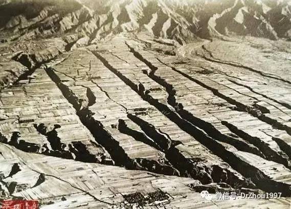 皮肤屏障功能受损后综合症