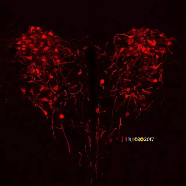 微观星球显微镜下的奇妙世界,显微镜下的奇妙世界视频