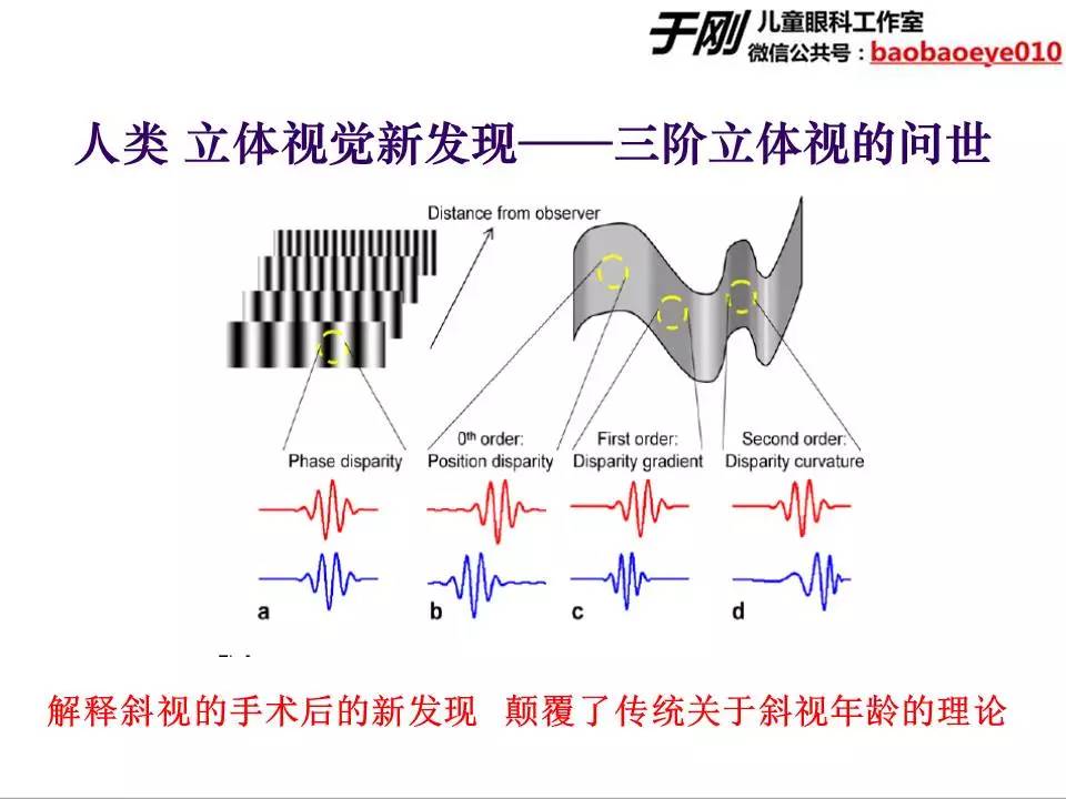 大龄弱视斜视训练,斜视弱视学网课推荐