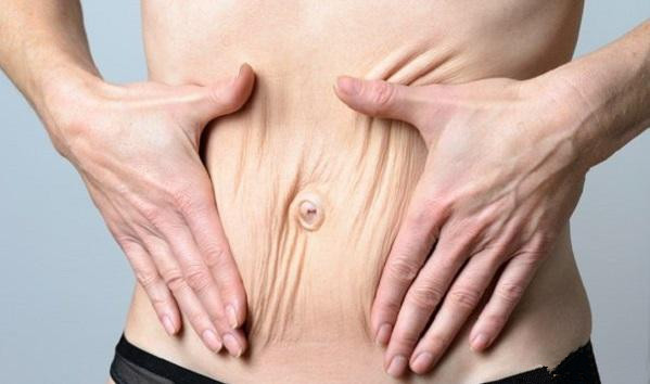 腹肌分离产后肚子大,腹肌分离产后几年可恢复