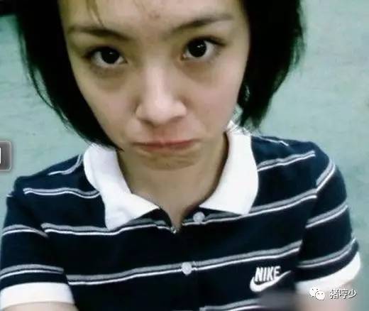 明星皮肤真的不长痘吗,脸上不长痘