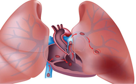 专家治疗肝硬化最新方法,专家谈肝硬化的调理菜谱