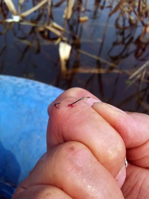 鱼钩刺肉如何处理,倒刺鱼钩钩进衣服怎么办