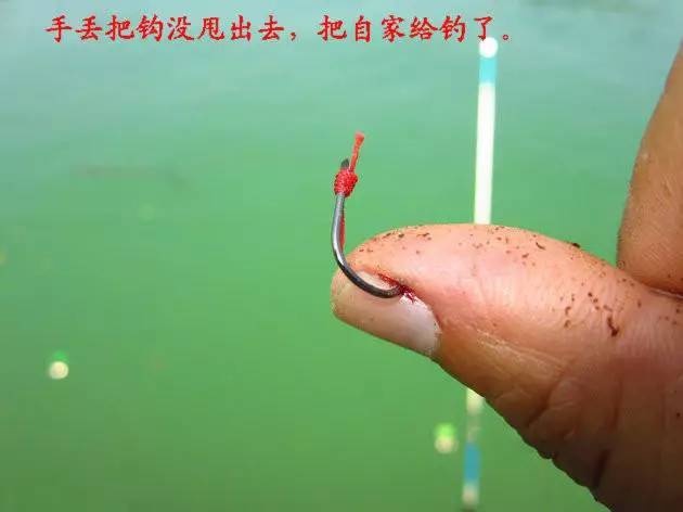 鱼钩刺肉如何处理,倒刺鱼钩钩进衣服怎么办