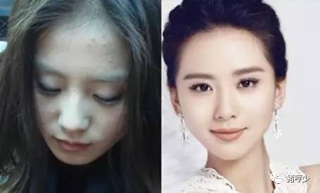 明星皮肤真的不长痘吗,脸上不长痘