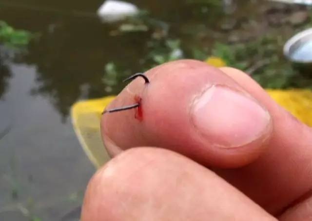 鱼钩刺肉如何处理,倒刺鱼钩钩进衣服怎么办