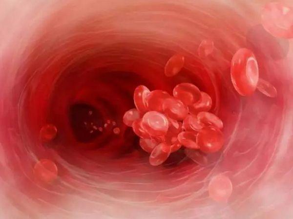 全身突然出现很多小红痣不痛不痒,身上突然长很多小红痣是什么原因