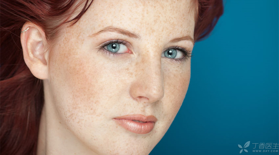 脸上长斑应该如何调理才能祛斑,脸上长斑最有效的祛斑方法